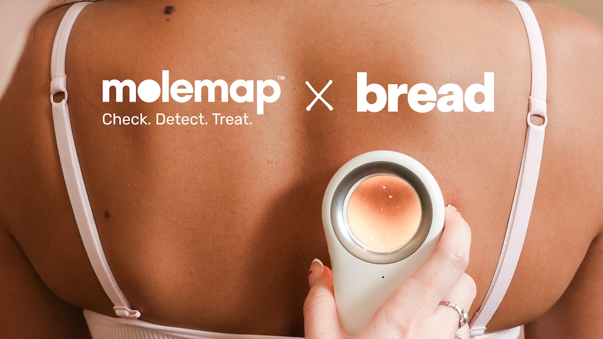 MoleMap appoints Bread Agency as social media agency partner across Australia and New Zealand